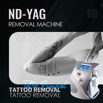 ND YAG Laser 1064nm 532nm Machine d' élimination des tatouages 1320nm Peeling au carbone