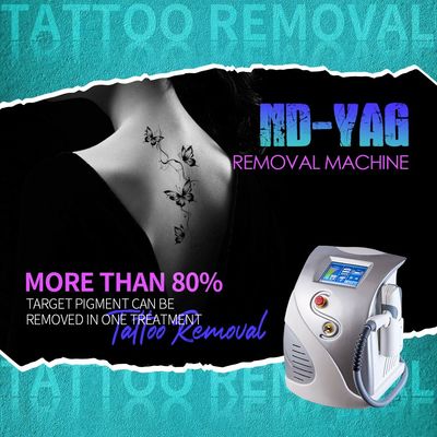 Machine de détachement de tatouage au laser ND YAG